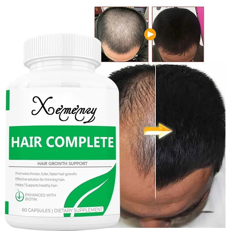 DHT Blocker Hair Growth Vitamins - Accessory Monk