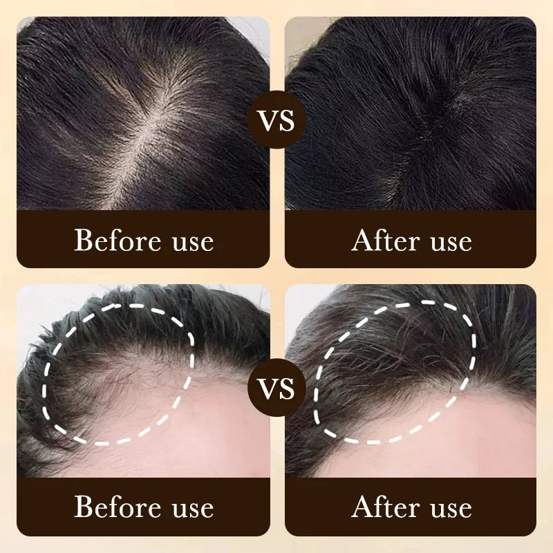 Anti Hair Loss Serum For Baldness Repair - Accessory Monk