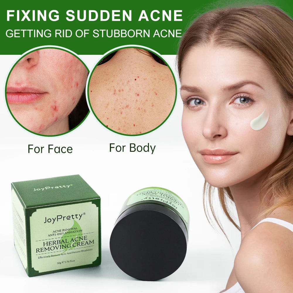 Natural Herbal Acne Treatment Face Cream - Accessory Monk