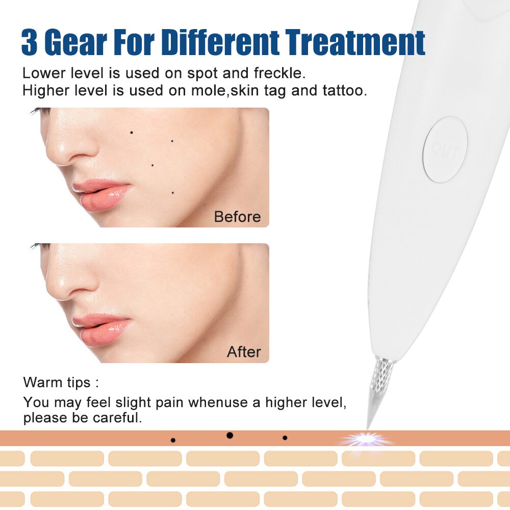 Plasma Pen Face Skin Tag Remover - Accessory Monk