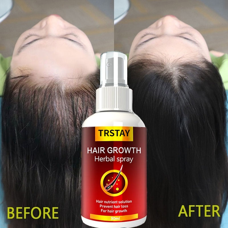 Spray Fast Hair Growth Liquid - Accessory Monk