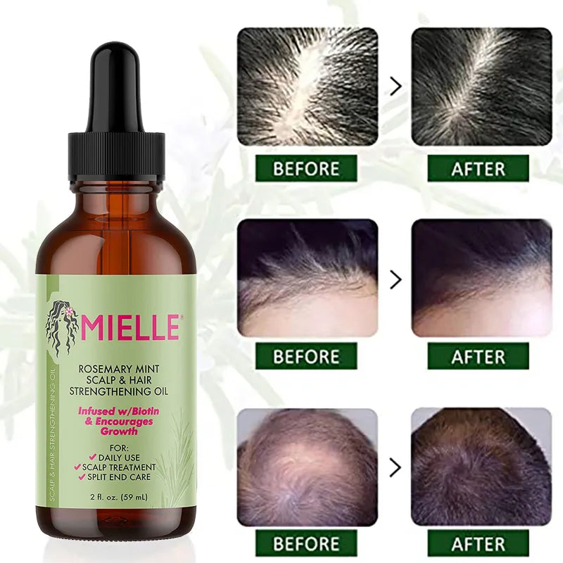 Hair Growth Essential Oil - Accessory Monk