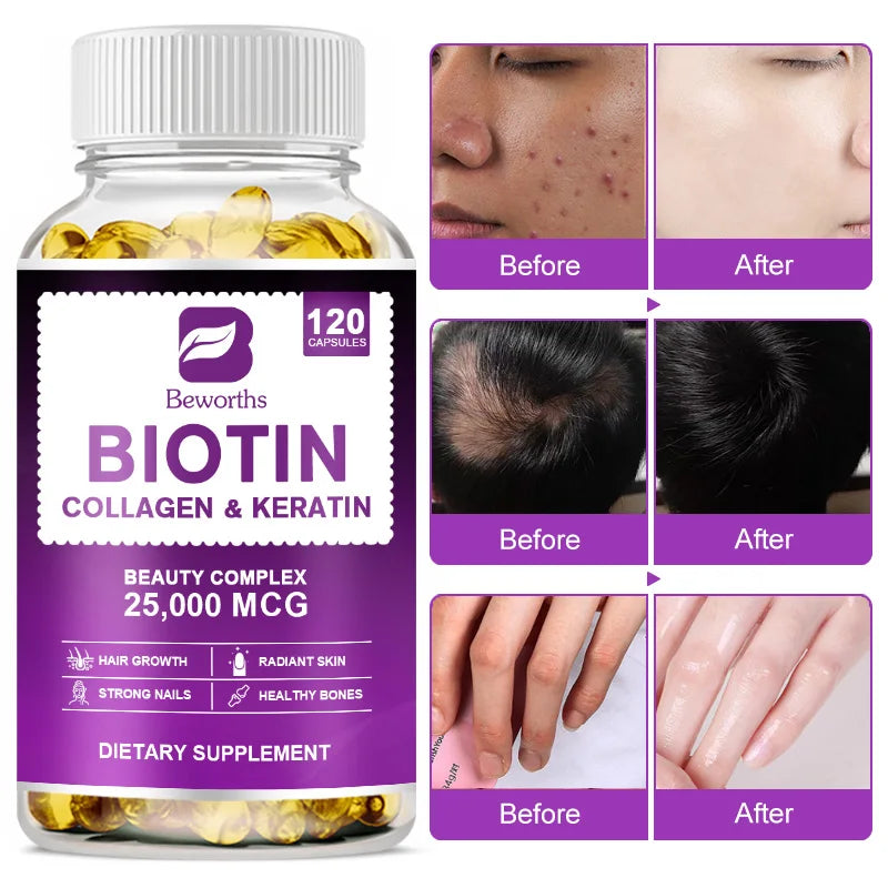 BW Biotin & Collagen Supplement - Accessory Monk