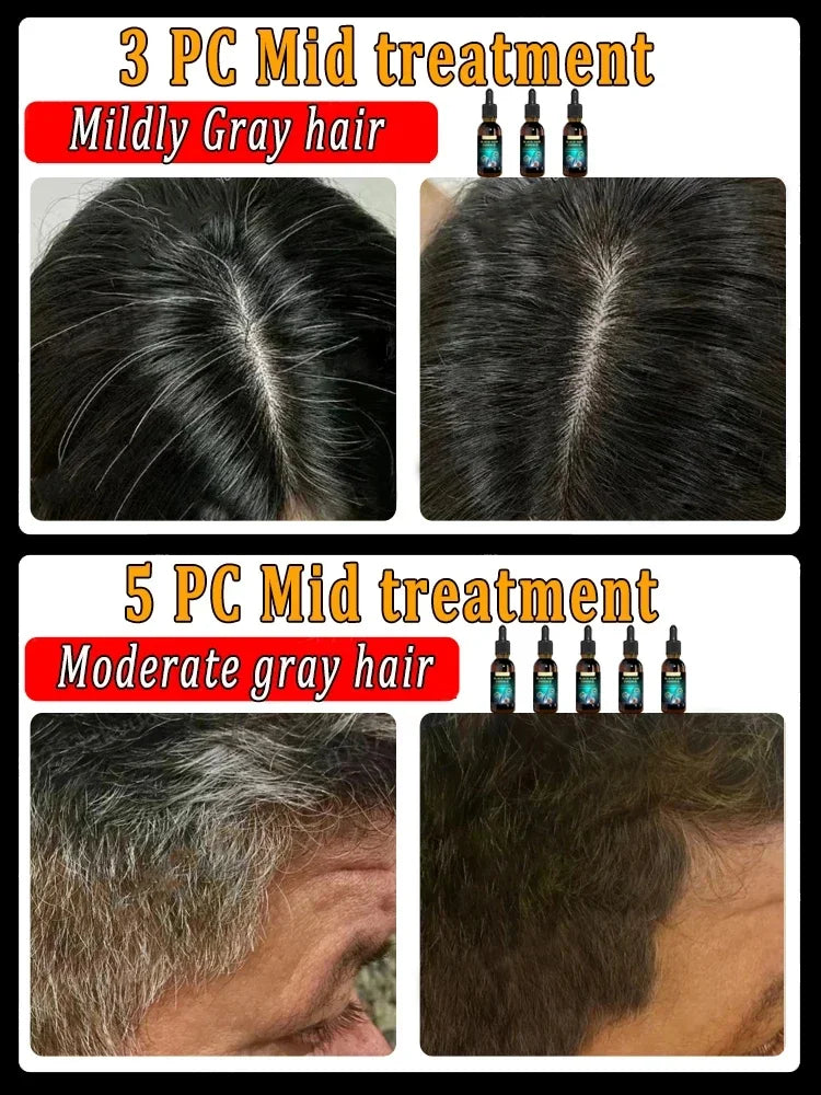 Anti-grey hair essence Serum - Accessory Monk