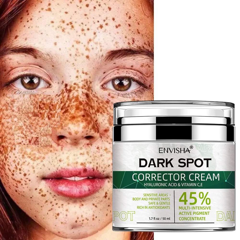 Skin Whitening Freckle Remover Cream - Accessory Monk