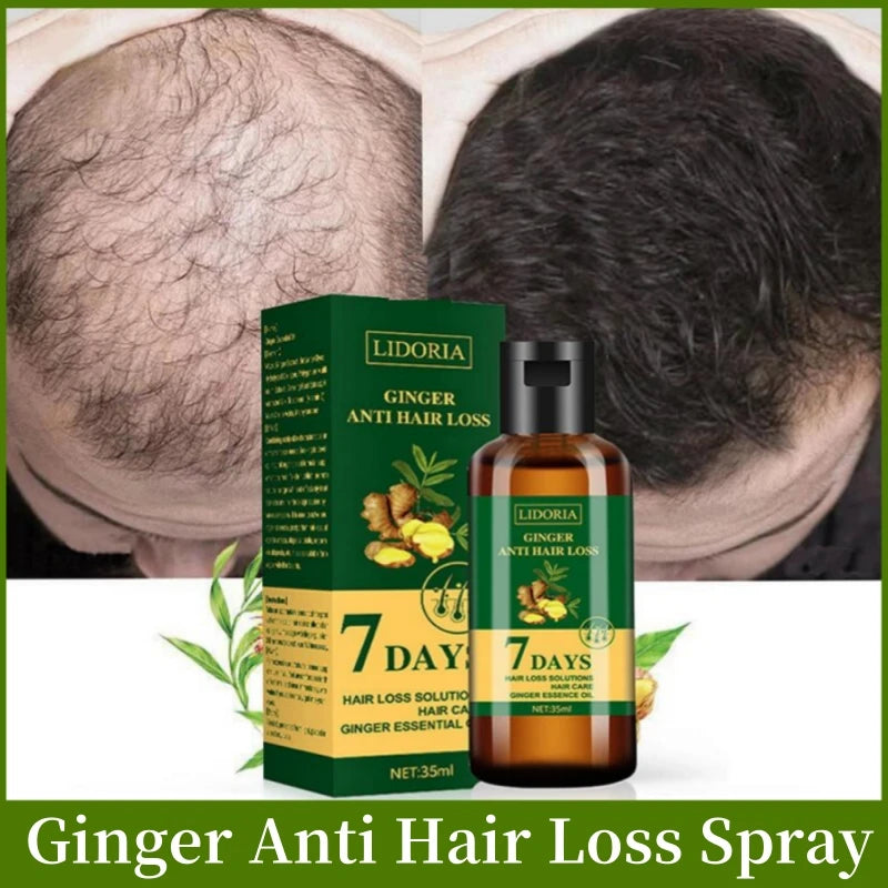 Ginger Anti Hair-loss Regrowth Serum Oil - Accessory Monk