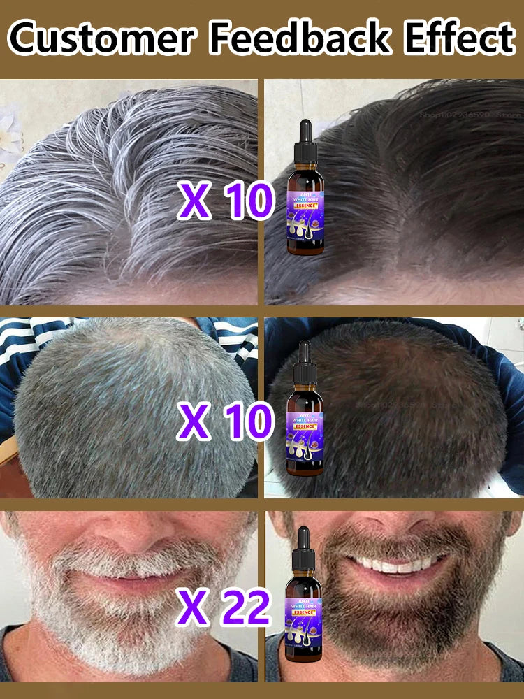 Gray Hair Treatment Serum - Accessory Monk