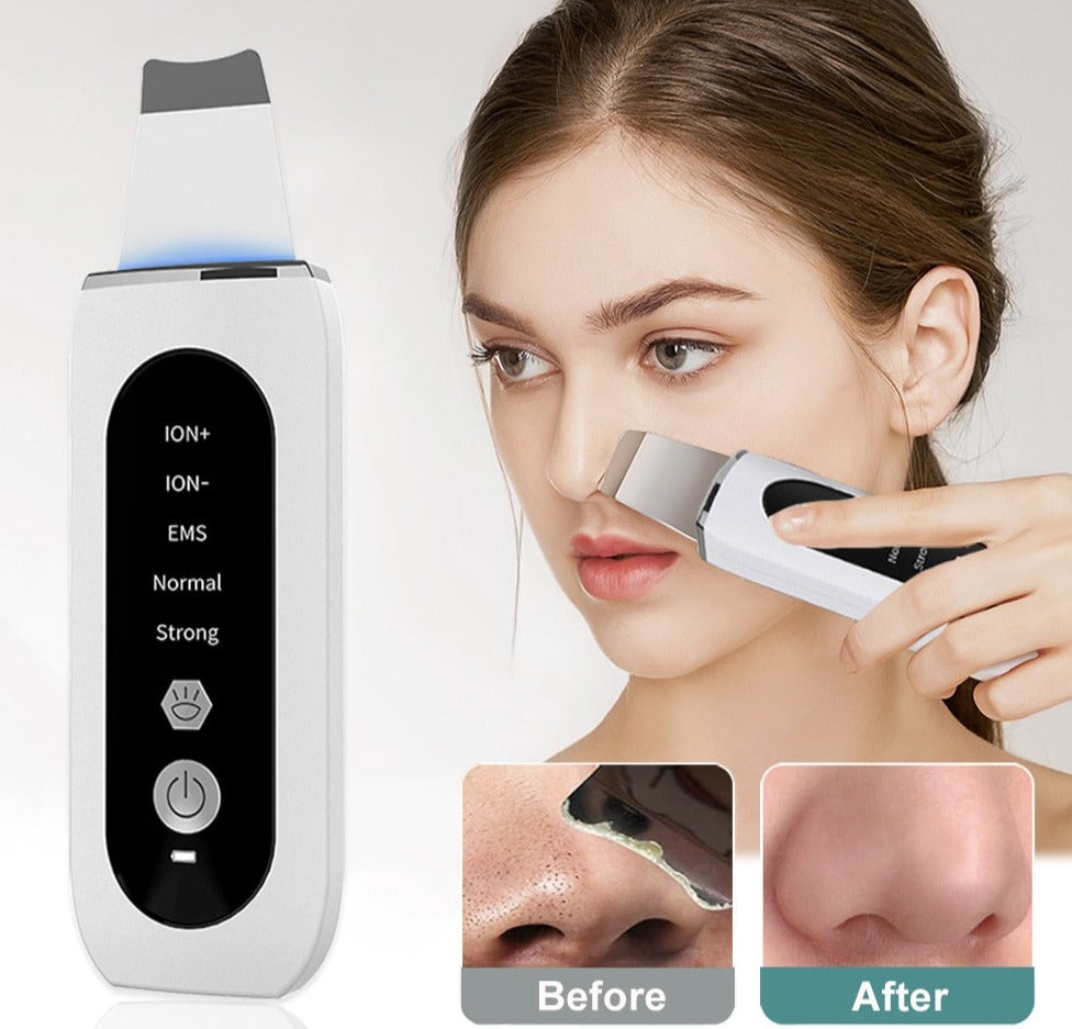 Ultrasonic Skin Scrubber Peeling Blackhead Remover - Accessory Monk